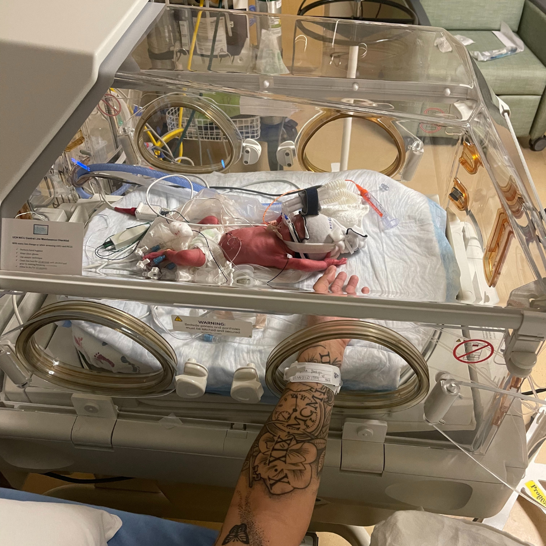 Hand in isolette touching NICU baby.